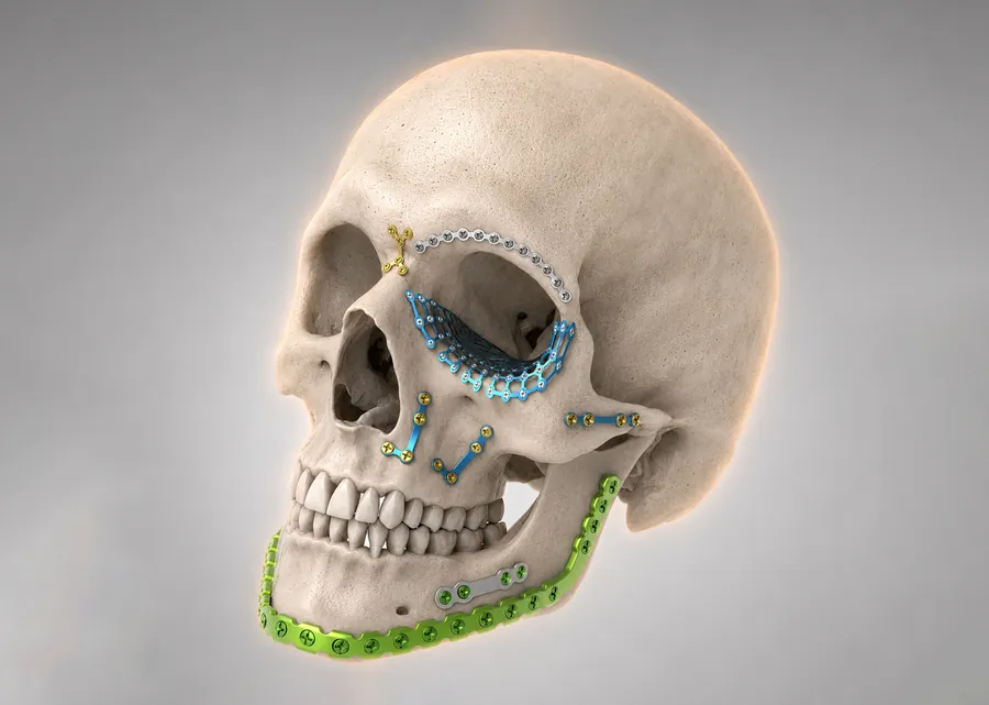 Maxilofacial